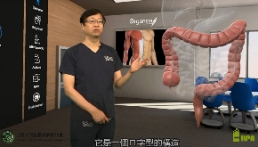 大腸癌防治衛教影片─大腸•大腸癌•大腸鏡附圖